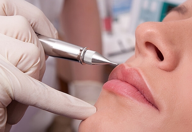 Как подготовиться к процедуре татуажа губ