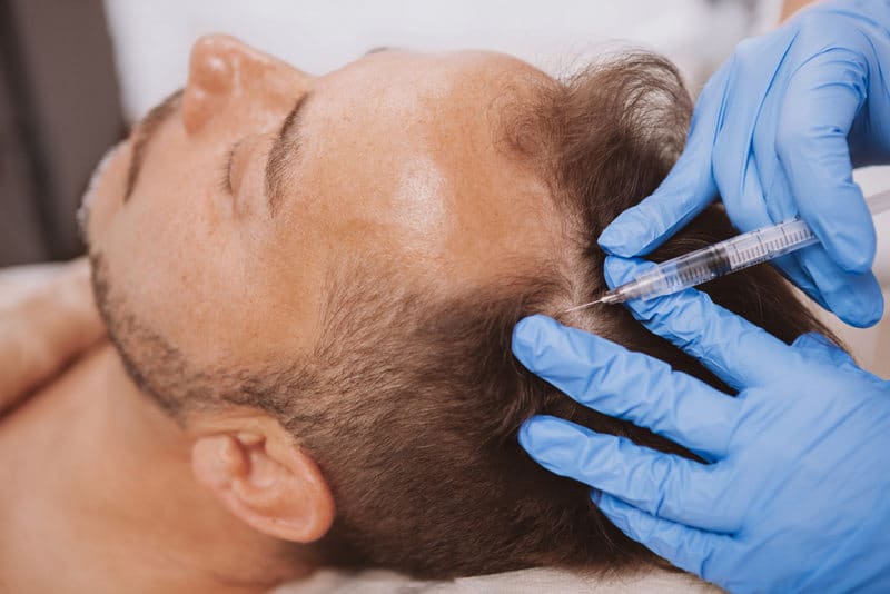 мезотерапия как способ укрепления волос